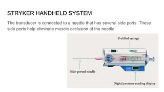 STRYKER HANDHELD SYSTEM
The transducer is connected to a needle that has several side ports. These
side ports help eliminate muscle occlusion of the needle
 