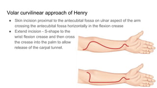 Volar curvilinear approach of Henry
● Skin incision proximal to the antecubital fossa on ulnar aspect of the arm
crossing the antecubital fossa horizontally in the flexion crease
● Extend incision - S-shape to the
wrist flexion crease and then cross
the crease into the palm to allow
release of the carpal tunnel.
 