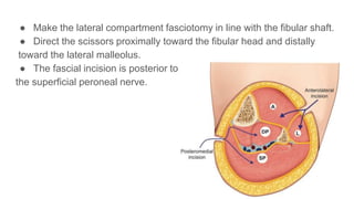 ● Make the lateral compartment fasciotomy in line with the fibular shaft.
● Direct the scissors proximally toward the fibular head and distally
toward the lateral malleolus.
● The fascial incision is posterior to
the superficial peroneal nerve.
 