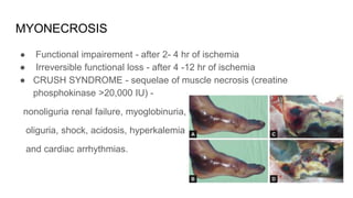 MYONECROSIS
● Functional impairement - after 2- 4 hr of ischemia
● Irreversible functional loss - after 4 -12 hr of ischemia
● CRUSH SYNDROME - sequelae of muscle necrosis (creatine
phosphokinase >20,000 IU) -
nonoliguria renal failure, myoglobinuria,
oliguria, shock, acidosis, hyperkalemia
and cardiac arrhythmias.
 