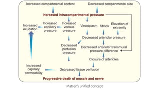 COMPARTMENT SYNDROME  