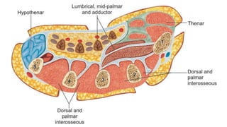 COMPARTMENT SYNDROME  