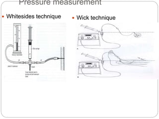 Pressure measurement
 Whitesides technique  Wick technique
 