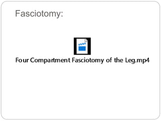 Fasciotomy:
 