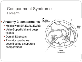 Compartment Syndrome
Forearm
 Anatomy-3 compartments
 Mobile wad-BR,ECRL,ECRB
 Volar-Superficial and deep
flexors
 Dorsal-Extensors
 Pronator quadratus
described as a separate
compartment
 