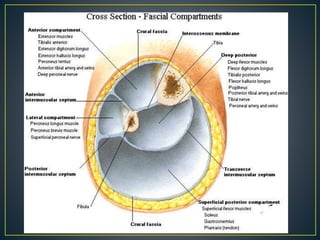 Compartment Sy Compartment syndromes | PPTX