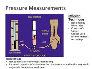 Infusion
Technique
• Designed by
Whitesides
• Consits of-
• Simple
• Can be used
for intermittent
recordings
Disadvantage-
• Not suitable for continuous monitoring
• Required injection of saline into the compartment and in this way could
aggravate impending syndrome
 