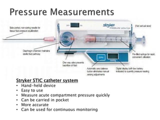 Stryker STIC catheter system
• Hand-held device
• Easy to use
• Measure acute compartment pressure quickly
• Can be carried in pocket
• More accurate
• Can be used for continuous monitoring
 