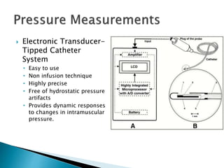  Electronic Transducer-
Tipped Catheter
System
• Easy to use
• Non infusion technique
• Highly precise
• Free of hydrostatic pressure
artifacts
• Provides dynamic responses
to changes in intramuscular
pressure.
 