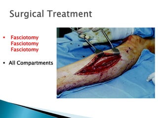  Fasciotomy
Fasciotomy
Fasciotomy
 All Compartments
 