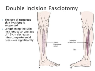  The use of generous
skin incisions is
supported
 Lengthening the skin
incisions to an average
of 16 cm decreases
intra compartmental
pressures significantly
 