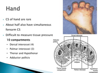 CS of hand are rare
 About half also have simultaneous
forearm CS
 Difficult to measure tissue pressure
10 compartments
• Dorsal interossei (4)
• Palmar interossei (3)
• Thenar and Hypothenar
• Adductor pollicis
 