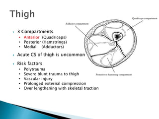  3 Compartments
• Anterior (Quadriceps)
• Posterior (Hamstrings)
• Medial (Adductors)
 Acute CS of thigh is uncommon
 Risk factors
• Polytrauma
• Severe blunt trauma to thigh
• Vascular injury
• Prolonged external compression
• Over lengthening with skeletal traction
 