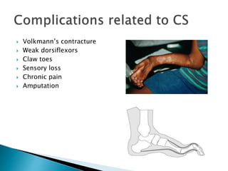  Volkmann’s contracture
 Weak dorsiflexors
 Claw toes
 Sensory loss
 Chronic pain
 Amputation
 