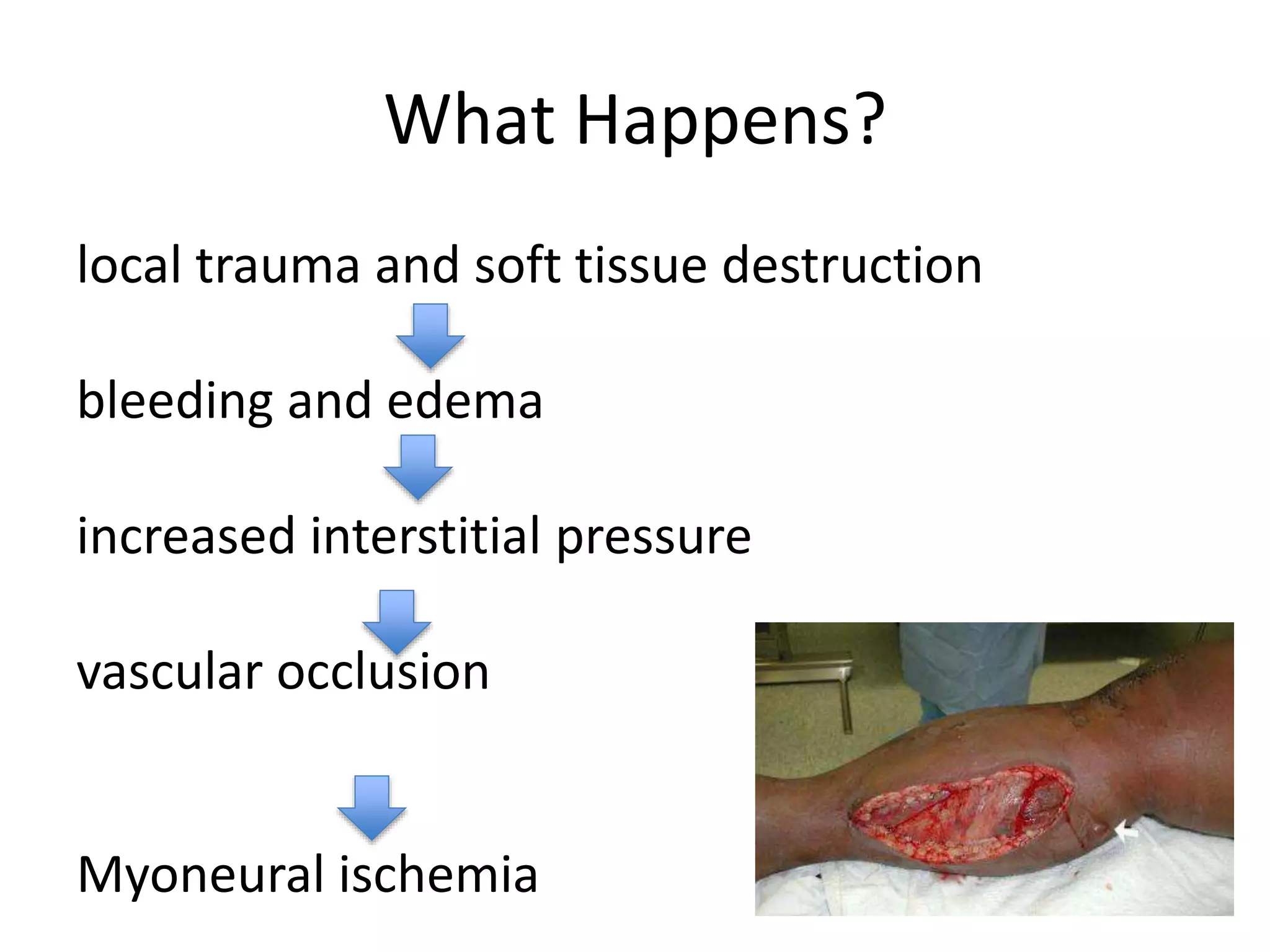 Compartment syndrome teaching | PPTX