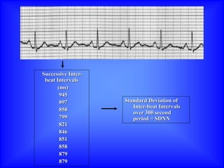 Successive Inter-
beat Intervals
(ms)
945
897
858
799
821
846
851
858
879
879
Standard Deviation of
Inter-beat Intervals
over 300 second
period = SDNN
 
