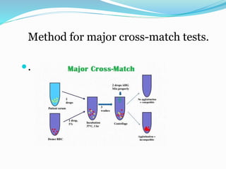 Method for major cross-match tests.
.
 