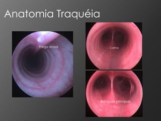 Anatomia Traquéia

      Prega dorsal         Carina




                     Brônquios principais
 