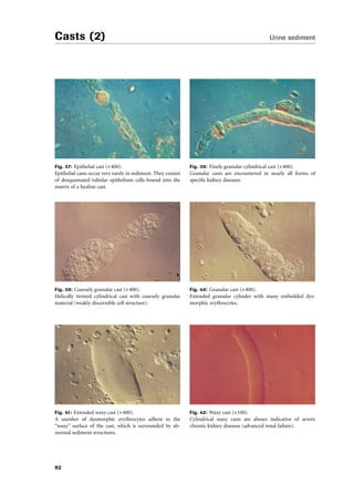 Compendium urinalysis | PDF