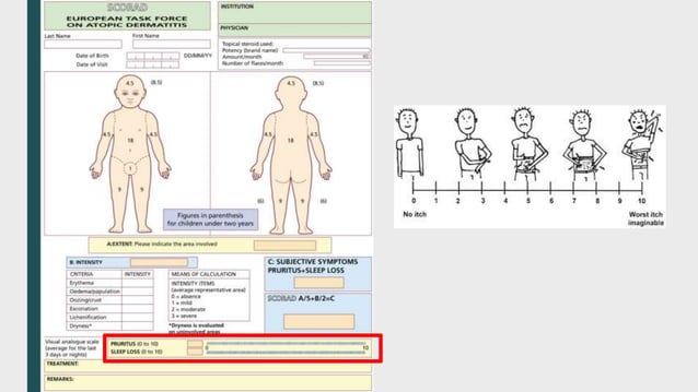 Compiled Scoring Systems in Dermatology_1650928171.pptx | Skin and ...