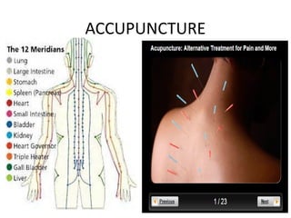 ACCUPUNCTURE
 