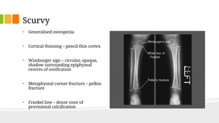 COMPLEMENTARY FEEDING Presentation. ppt. | PPTX