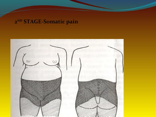 2ND
STAGE-Somatic pain
 