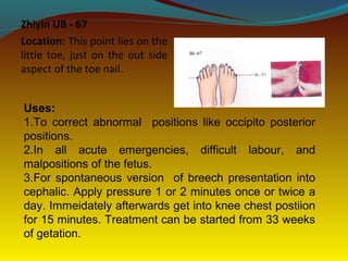 Zhiyin UB - 67
Location: This point lies on the
little toe, just on the out side
aspect of the toe nail.
Uses:
1.To correct abnormal positions like occipito posterior
positions.
2.In all acute emergencies, difficult labour, and
malpositions of the fetus.
3.For spontaneous version of breech presentation into
cephalic. Apply pressure 1 or 2 minutes once or twice a
day. Immeidately afterwards get into knee chest postiion
for 15 minutes. Treatment can be started from 33 weeks
of getation.
 