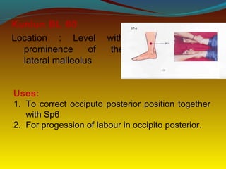 Kunlun BL 60
Location : Level with
prominence of the
lateral malleolus
Uses:
1. To correct occiputo posterior position together
with Sp6
2. For progession of labour in occipito posterior.
 