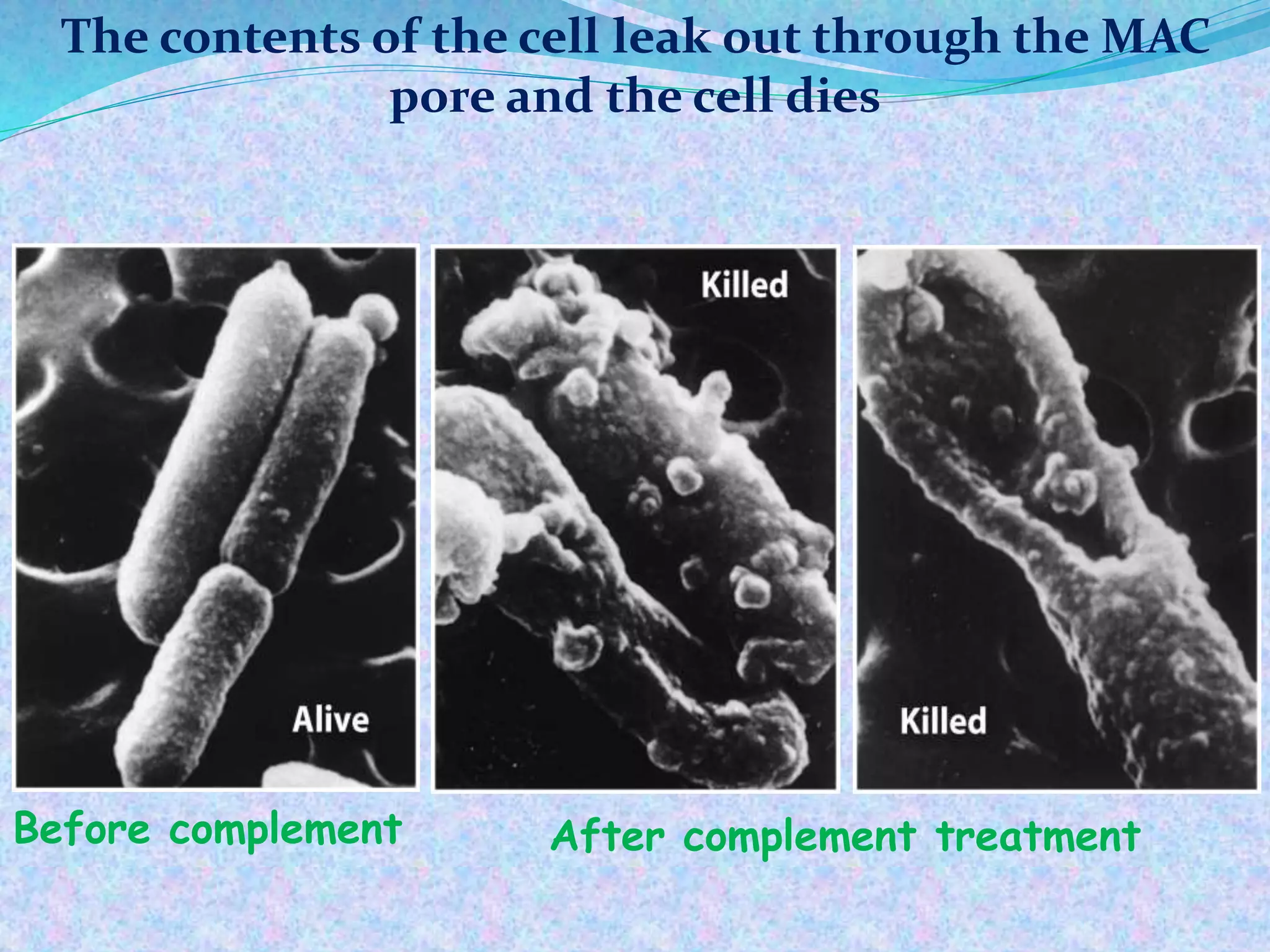 Before complement After complement treatment
The contents of the cell leak out through the MAC
pore and the cell dies
 