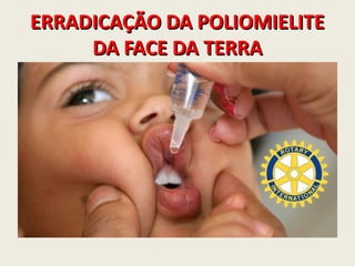 ERRADICAÇÃO DA POLIOMIELITEERRADICAÇÃO DA POLIOMIELITE
DA FACE DA TERRADA FACE DA TERRA
 