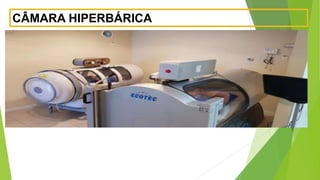 CÂMARA HIPERBÁRICA
 