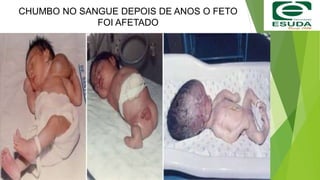 CHUMBO NO SANGUE DEPOIS DE ANOS O FETO
FOI AFETADO
 