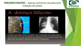 PNEUMOCONIOSE – doença pulmonar causada pela
inalação de poeira
 