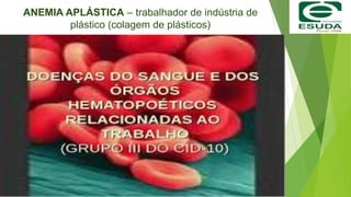 ANEMIA APLÁSTICA – trabalhador de indústria de
plástico (colagem de plásticos)
 
