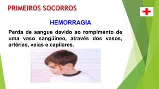 HEMORRAGIA
Perda de sangue devido ao rompimento de
uma vaso sangüíneo, através dos vasos,
artérias, veias e capilares.
 