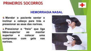 HEMORRAGIA NASAL
Mandar o paciente sentar e
inclinar a cabeça para trás e
pressionar as asas das narinas.
Pressionar o “freio” que liga
lábio-superior ao maxilar
superior e colocar uma
compressa com gelo nas
narinas.
 