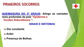QUEIMADURA DO 2º GRAUS: Atinge as camadas
mais profundas da pele “Epiderme e
Tecidos Subcutâneos ”.
SINAIS E SINTOMAS
Dor constante
Ardor
Presença de Bolhas.
 
