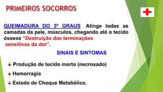 QUEIMADURA DO 3º GRAUS: Atinge todas as
camadas da pele, músculos, chegando até o tecido
ósseos “Destruição das terminações
sensitivas da dor”.
SINAIS E SINTOMAS
Produção de tecido morto (necrosado)
Hemorragia
Estado de Choque Metabólico.
 