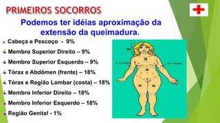 Podemos ter idéias aproximação da
extensão da queimadura.
Cabeça e Pescoço - 9%
Membro Superior Direito – 9%
Membro Superior Esquerdo – 9%
Tórax e Abdômen (frente) – 18%
Tórax e Região Lombar (costa) – 18%
Membro Inferior Direito – 18%
Membro Inferior Esquerdo – 18%
Região Genital - 1%
 