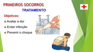 TRATAMENTO
Objetivos:
Avaliar a dor
Evitar infecção
Prevenir o choque
 