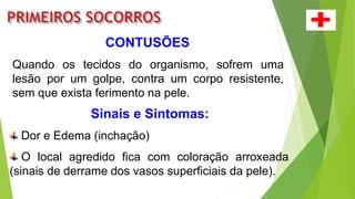 CONTUSÕES
Quando os tecidos do organismo, sofrem uma
lesão por um golpe, contra um corpo resistente,
sem que exista ferimento na pele.
Sinais e Sintomas:
Dor e Edema (inchação)
O local agredido fica com coloração arroxeada
(sinais de derrame dos vasos superficiais da pele).
 