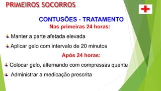 CONTUSÕES - TRATAMENTO
Nas primeiras 24 horas:
Manter a parte afetada elevada
Aplicar gelo com intervalo de 20 minutos.
Após 24 horas:
Colocar gelo, alternando com compressas quente
Administrar a medicação prescrita
 