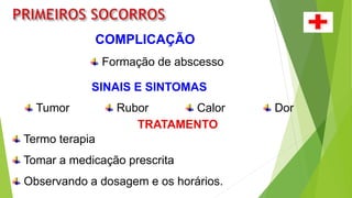 COMPLICAÇÃO
Formação de abscesso
SINAIS E SINTOMAS
Tumor Rubor Calor Dor
TRATAMENTO
Termo terapia
Tomar a medicação prescrita
Observando a dosagem e os horários.
 