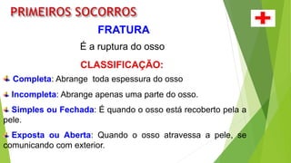 FRATURA
É a ruptura do osso
CLASSIFICAÇÃO:
Completa: Abrange toda espessura do osso
Incompleta: Abrange apenas uma parte do osso.
Simples ou Fechada: É quando o osso está recoberto pela a
pele.
Exposta ou Aberta: Quando o osso atravessa a pele, se
comunicando com exterior.
 