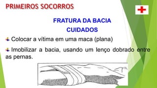 FRATURA DA BACIA
Colocar a vítima em uma maca (plana)
Imobilizar a bacia, usando um lenço dobrado entre
as pernas.
CUIDADOS
 