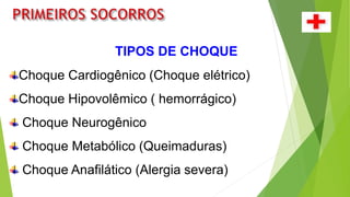 TIPOS DE CHOQUE
Choque Cardiogênico (Choque elétrico)
Choque Hipovolêmico ( hemorrágico)
Choque Neurogênico
Choque Metabólico (Queimaduras)
Choque Anafilático (Alergia severa)
 