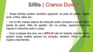 Sífilis ( Cranco Duro )
 Estas feridas podem também aparecer na pele do pênis, região
anal, virilha, lábio etc...
 Um à três meses depois da infecção pode começar a surgir febre,
perda de peso, falta de apetite, dor na juntas, aparecimento de
ínguas e manchas pelo o corpo.
 Com a passar dos ano, se o SÍFILIS não for tratado corretamente,
podem surgir lesões graves no coração, cérebro, olhos e outros
órgãos importantes.
 