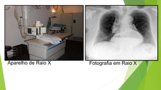 Aparelho de Raio X Fotografia em Raio X
CIÊNCIAS, 9º Ano
Efeitos do eletromagnetismo no cotidiano
 