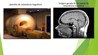 Aparelho de ressonância magnética
Imagem gerada de um exame de
ressonância magnética
 